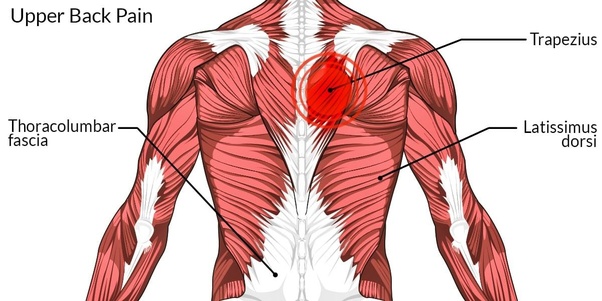 how-to-fix-upper-back-pain